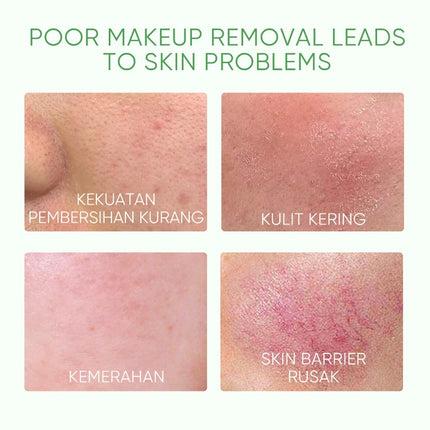 SKINTIFIC - Mugwort Calm Down Micellar Water 75ml